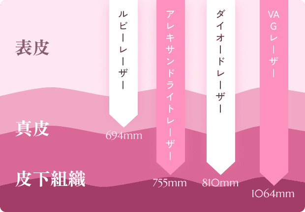 レーザーの効果の違いを表す表