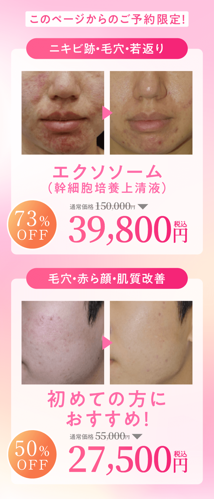 ５名様限定価格55000円