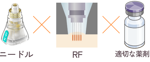 ニードル×RF×適切な薬剤