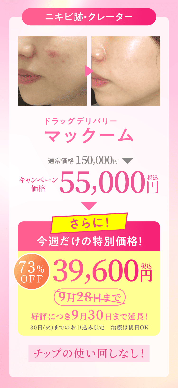 ５名様限定価格55000円