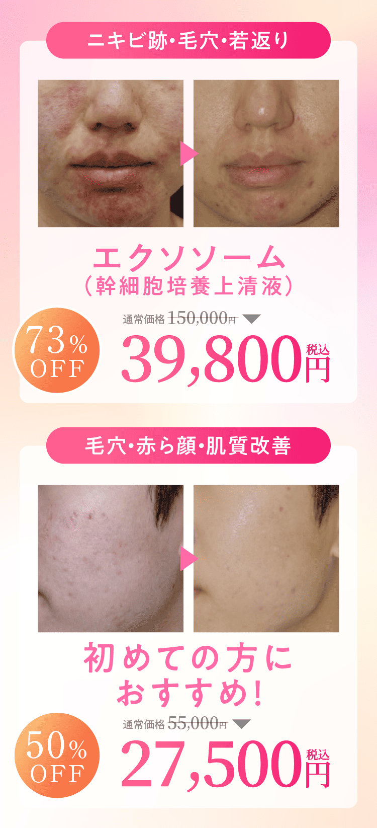 ５名様限定価格55000円