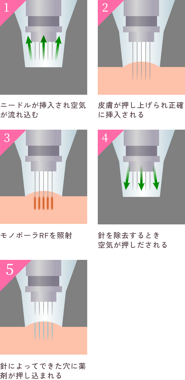 ドラッグデリバリーシステムについて